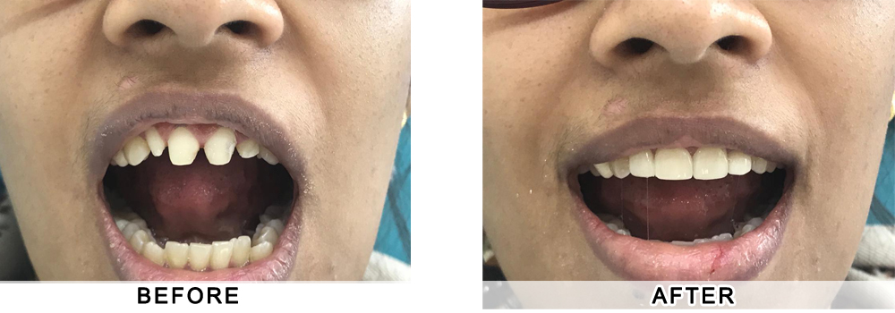 dentist patient2